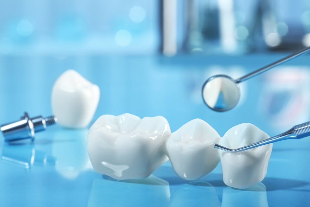 Dental bridge model with three artificial teeth placed together, surrounded by dental tools including a mirror and explorer on a reflective blue surface.