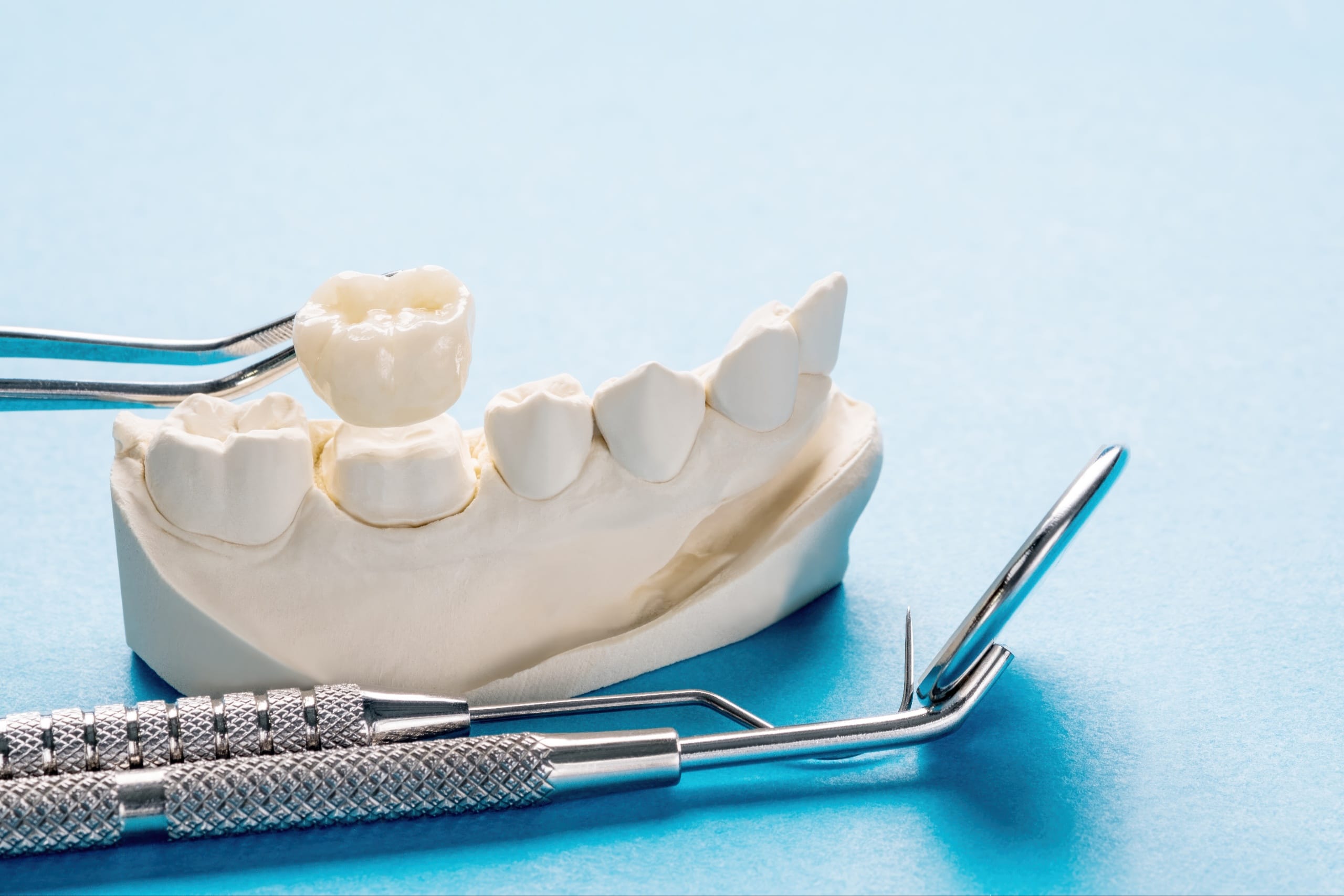 Dental Crown Dental tools beside a dental model showing a tooth crown being placed with tweezers on a blue background.