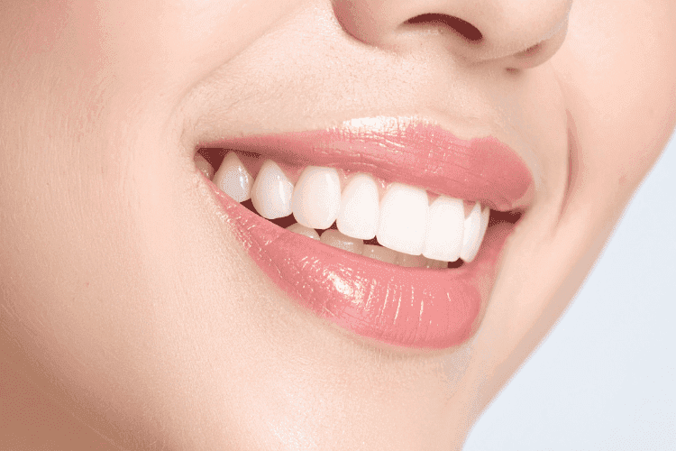 With proper care and regular dental visits, new veneers can last for decades.
