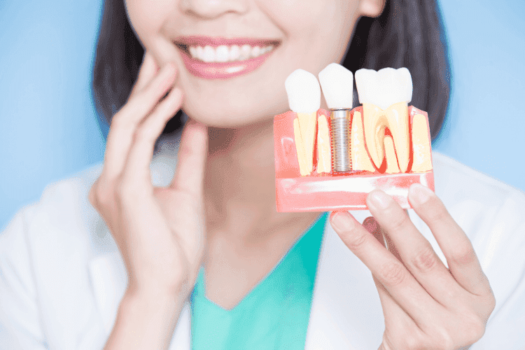 Dental implants are a permanent solution to missing teeth.