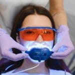 How Long Does Teeth Whitening Last? What You Need to Know
