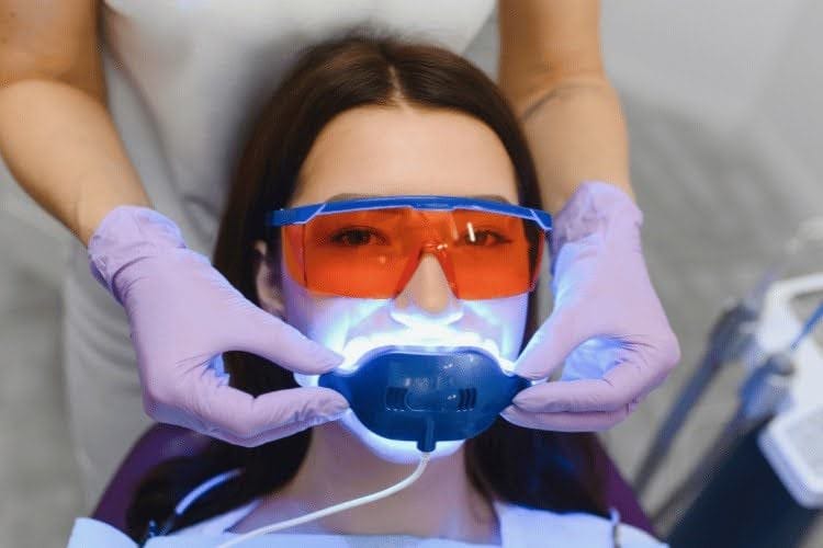 How Long Does Teeth Whitening Last? What You Need to Know