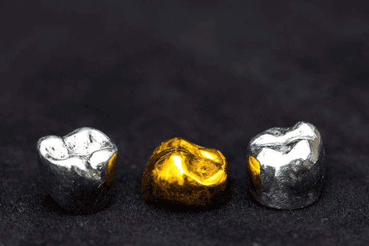 Comparison of gold dental crown and silver dental crowns.
